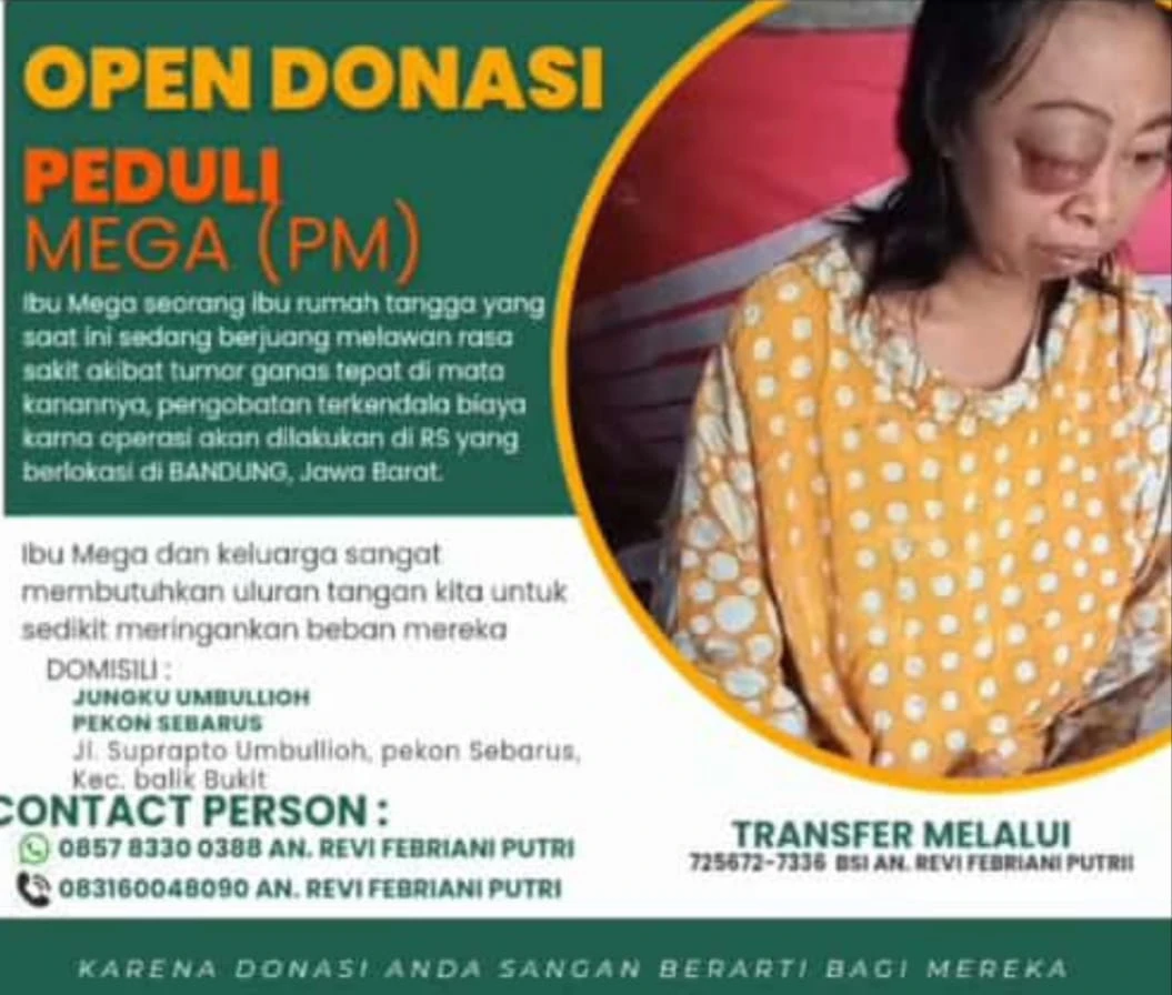 Megawati Mengharapkan Uluran Bantuan Untuk  Biaya Pengobatan Tumor Mata